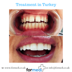 clinic Turkey dental
