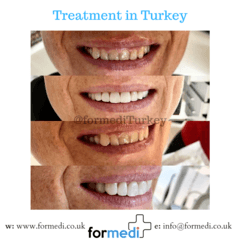 clinic Turkey dental