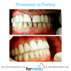 clinic Turkey dental