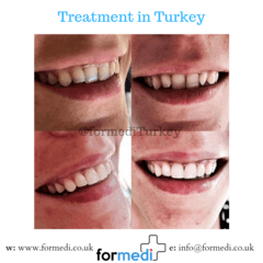 clinic Turkey dental