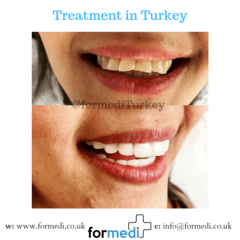 clinic Turkey dental