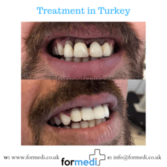 clinic Turkey dental