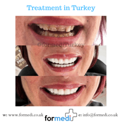 clinic Turkey dental