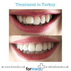 clinic Turkey dental