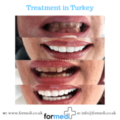 clinic Turkey dental