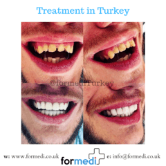clinic Turkey dental