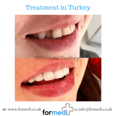 clinic Turkey dental