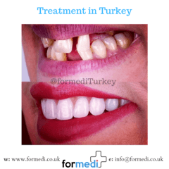 clinic Turkey dental