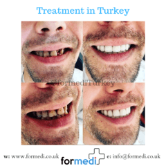 clinic Turkey dental