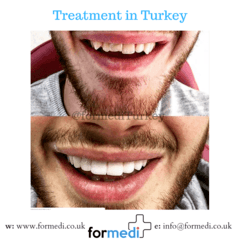clinic Turkey dental