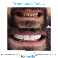 clinic Turkey dental