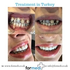 clinic Turkey dental