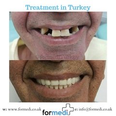 clinic Turkey dental