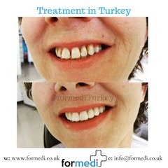 clinic Turkey dental