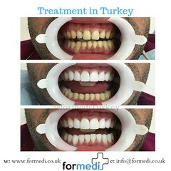 clinic Turkey dental