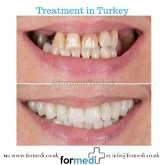 clinic Turkey dental