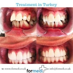 clinic Turkey dental