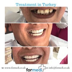 clinic Turkey dental