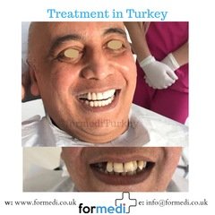clinic Turkey dental