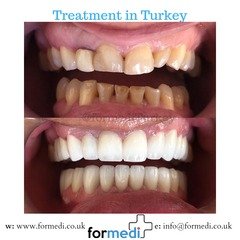 clinic Turkey dental