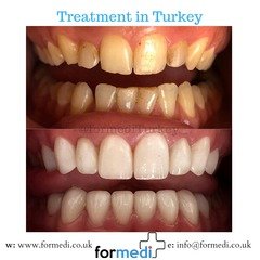 clinic Turkey dental