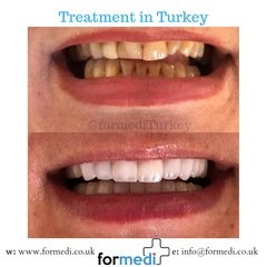 clinic Turkey dental