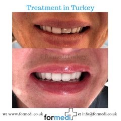 clinic Turkey dental