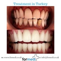 clinic Turkey dental