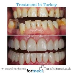 clinic Turkey dental