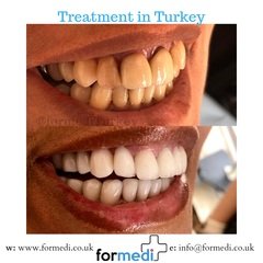 clinic Turkey dental