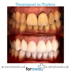clinic Turkey dental