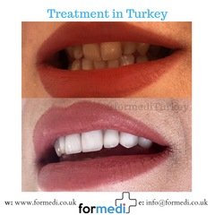 clinic Turkey dental