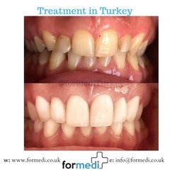 clinic Turkey dental