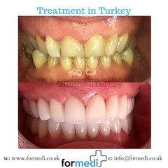 clinic Turkey dental