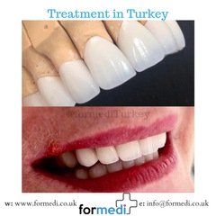 clinic Turkey dental