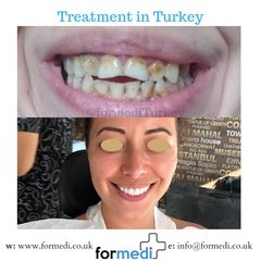 clinic Turkey dental