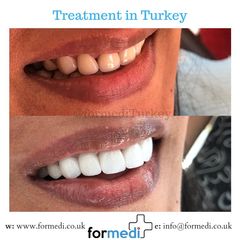 clinic Turkey dental