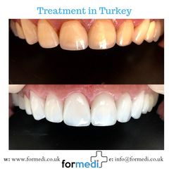 clinic Turkey dental