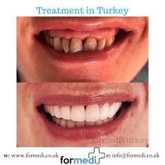 clinic Turkey dental