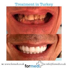 clinic Turkey dental