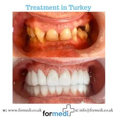 clinic Turkey dental