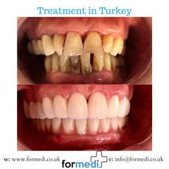 clinic Turkey dental