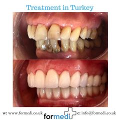 clinic Turkey dental