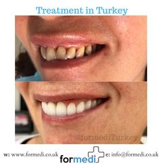 clinic Turkey dental