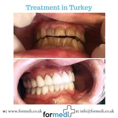 clinic Turkey dental