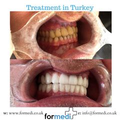 clinic Turkey dental