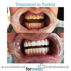 clinic Turkey dental
