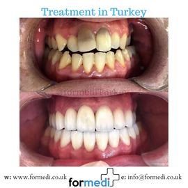 clinic Turkey dental