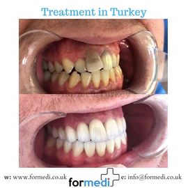 clinic Turkey dental