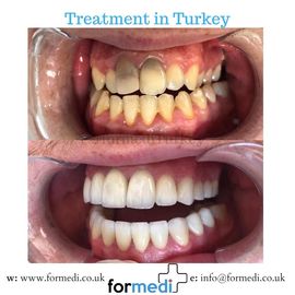 clinic Turkey dental